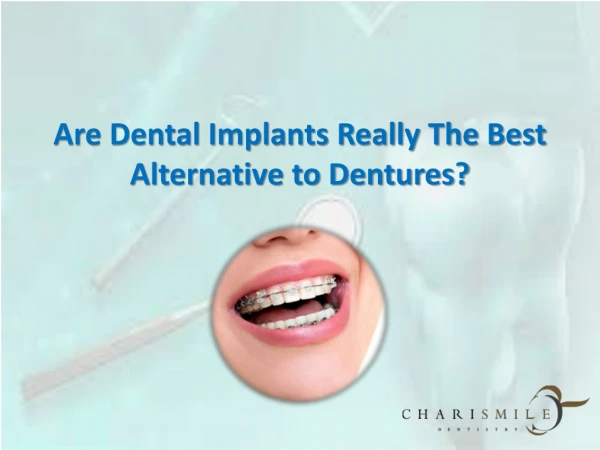 Are Dental Implants Really The Best Alternative to Dentures?