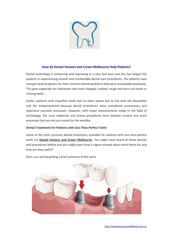 How do Dental Veneers and Crown Melbourne Help Patients?
