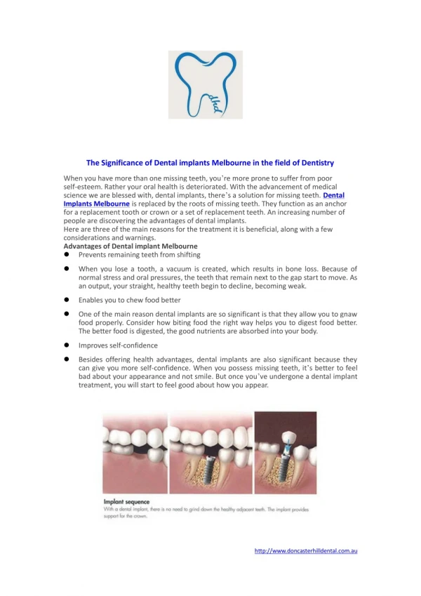 The Significance of Dental implants Melbourne in the field of Dentistry