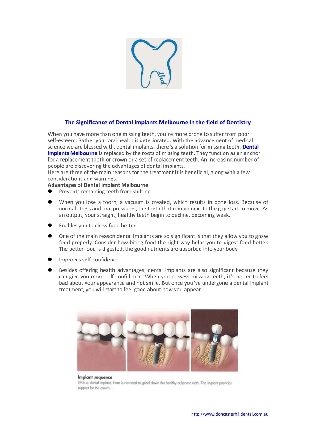 the significance of dental implants melbourne