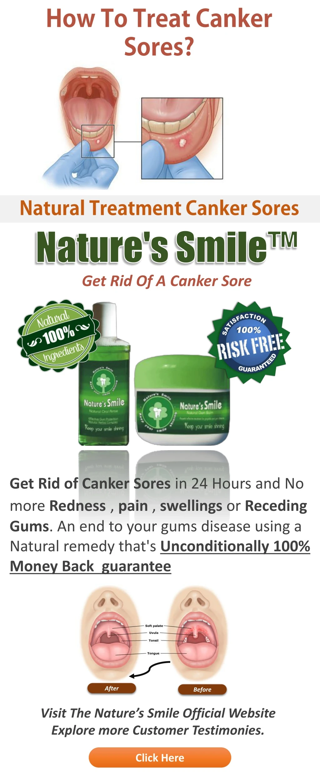 get rid of a canker sore