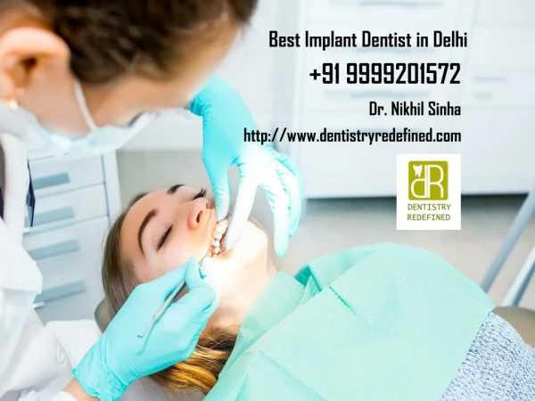 Best Implant Dentist in Delhi | Dial 91 9999201572