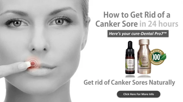 Get Rid Of Canker Sore Fast