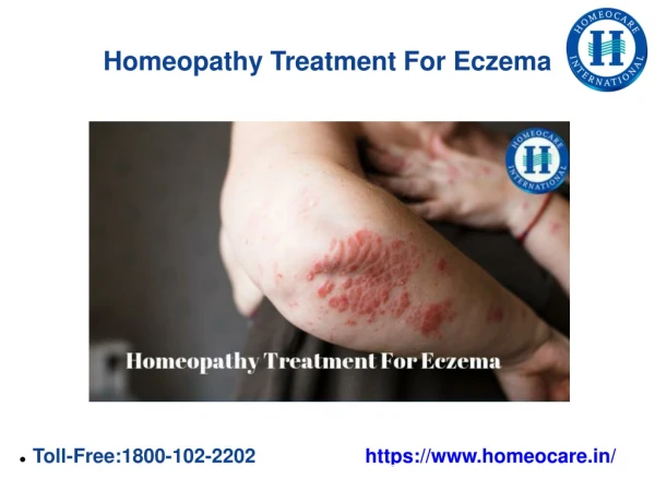 Homeopathy Treatment For Eczema