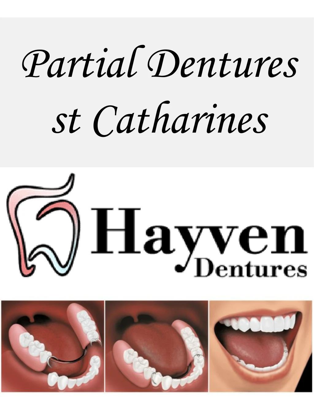 partial dentures st catharines
