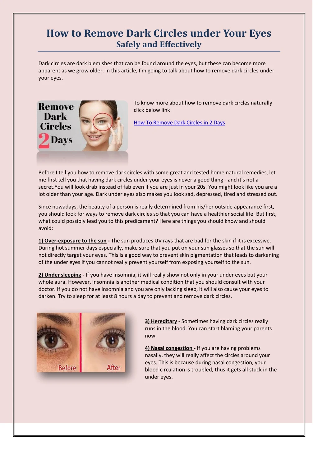 how to remove dark circles under your eyes safely