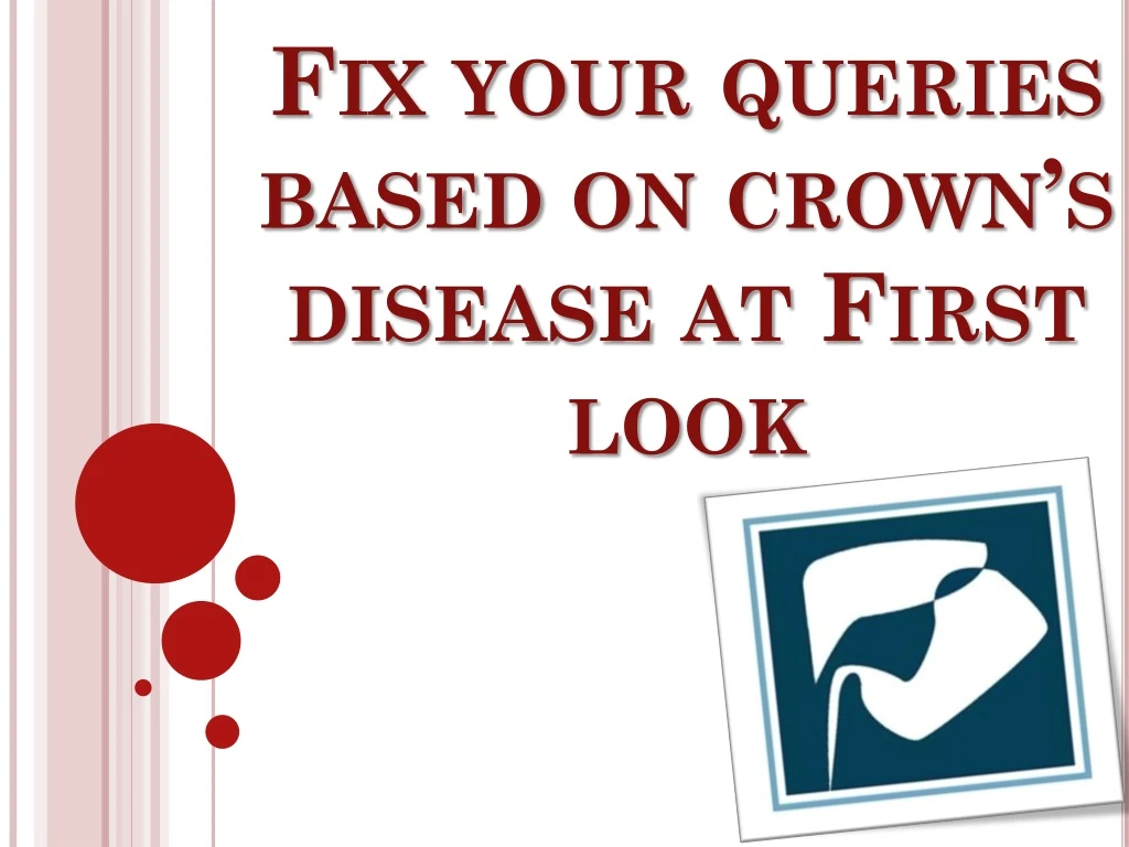 fix your queries based on crown s disease at first look