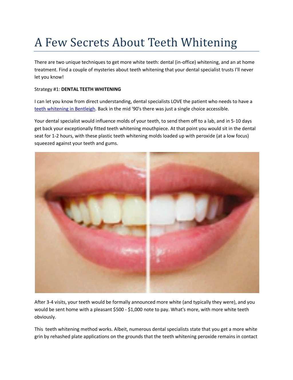 a few secrets about teeth whitening
