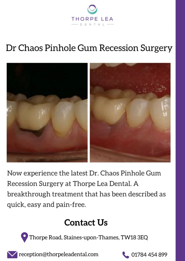 Dr Chaos Pinhole Gum Recession Surgery