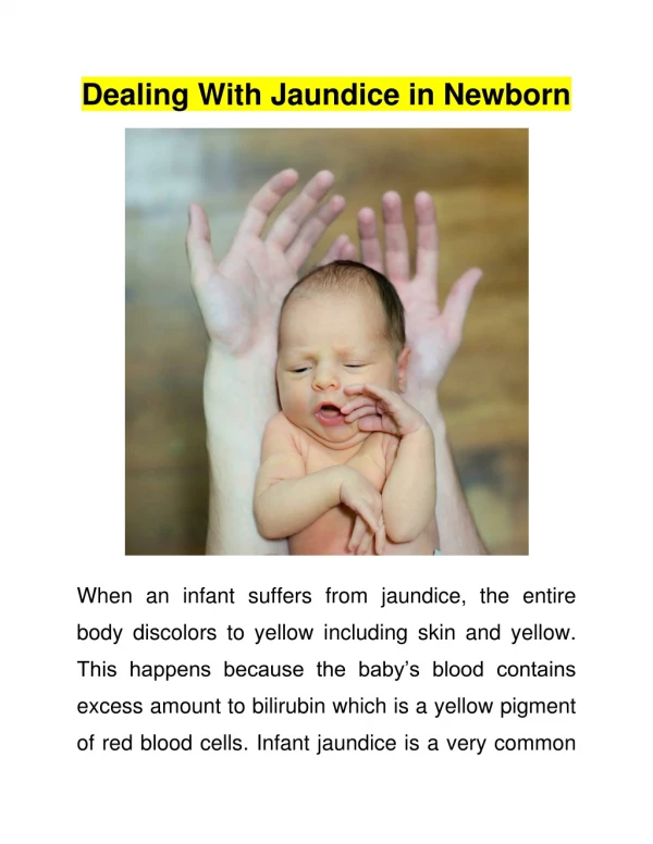 Dealing With Jaundice in Newborn