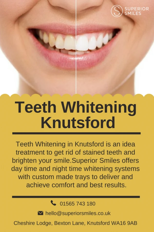 Teeth Whitening Knutsford