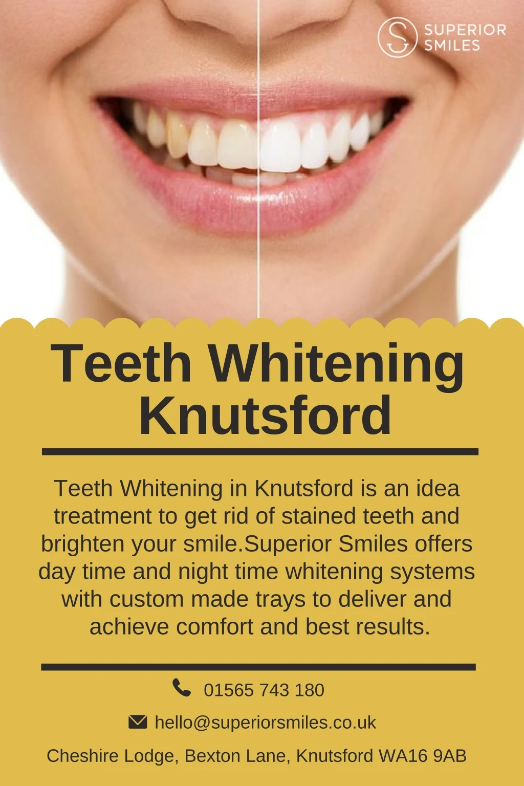 teeth whitening knutsford