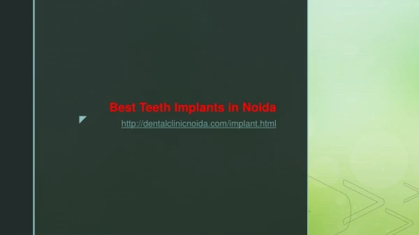 Best Teeth Implants in Noida