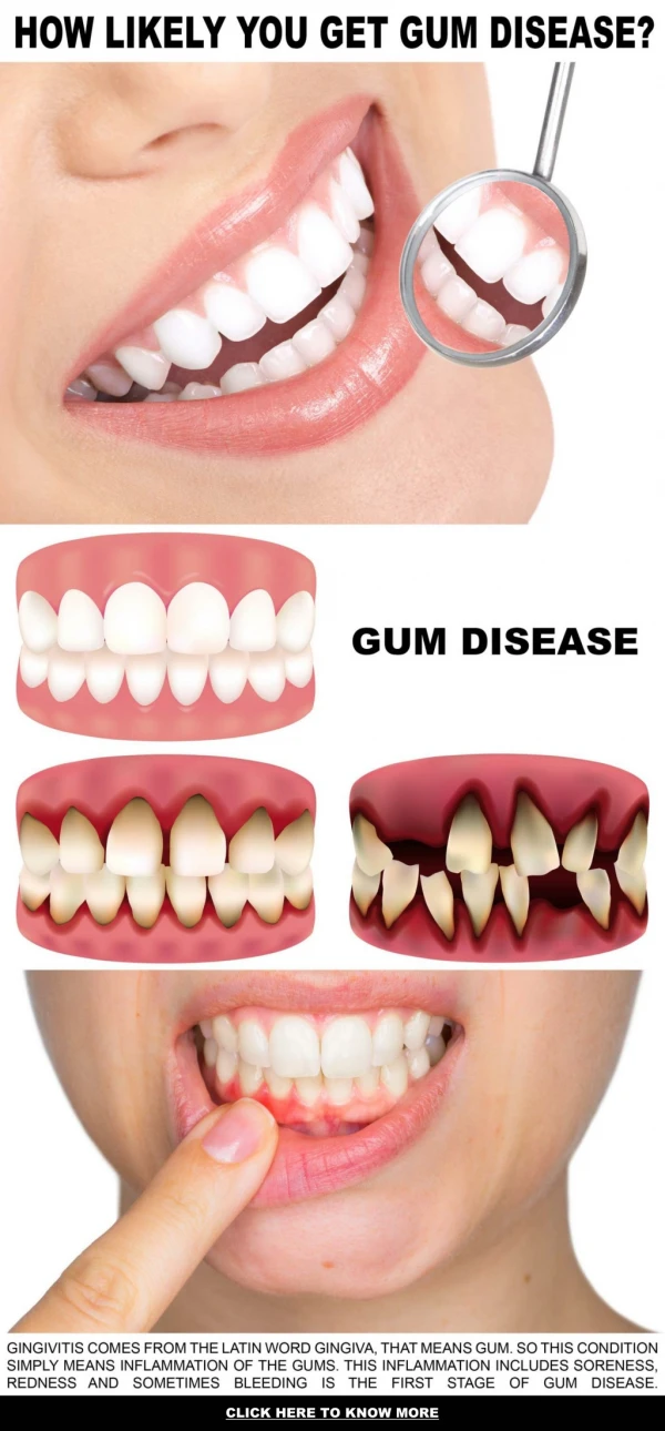 HOW LIKELY YOU GET GUM DISEASE?