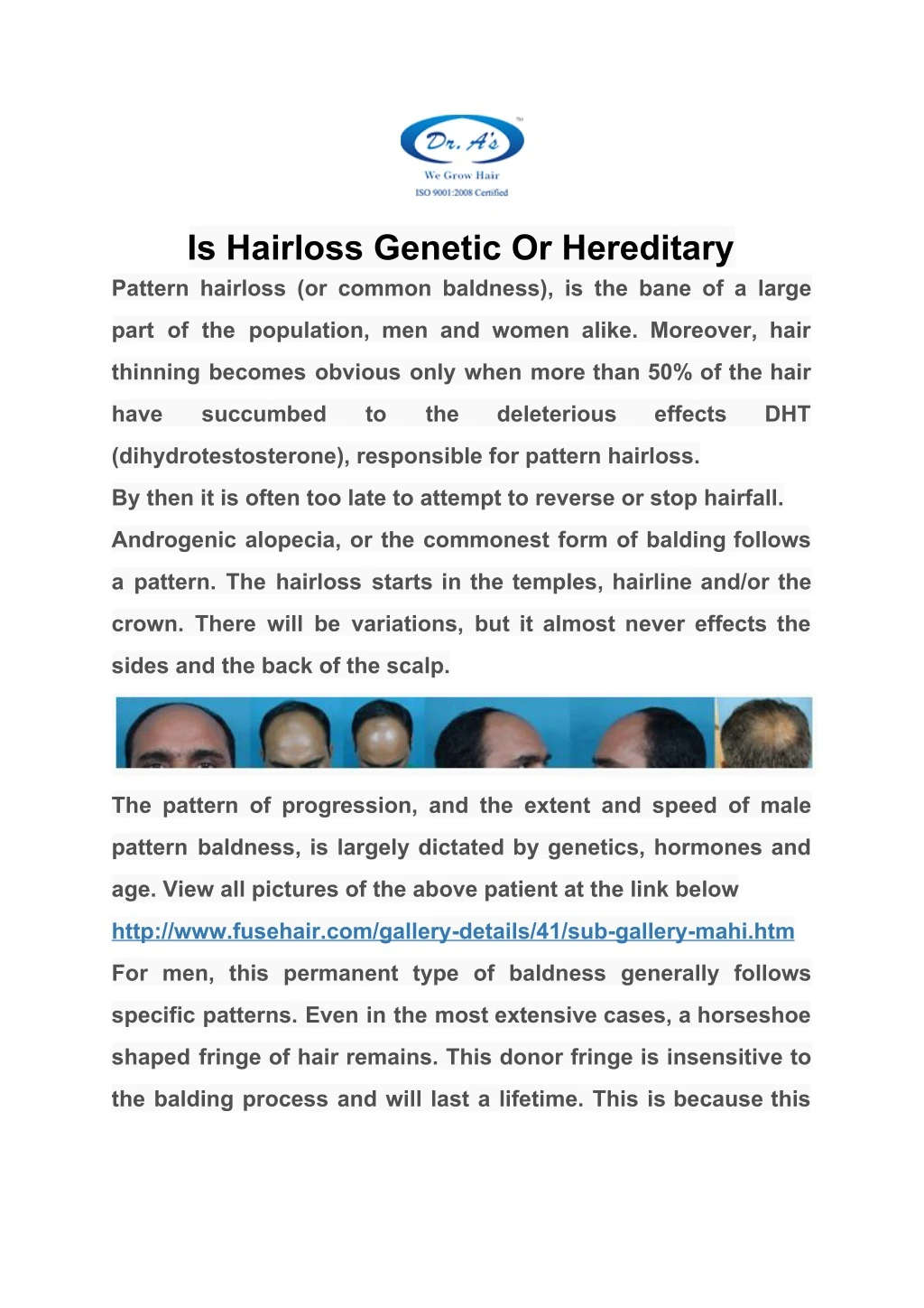 is hairloss genetic or hereditary pattern