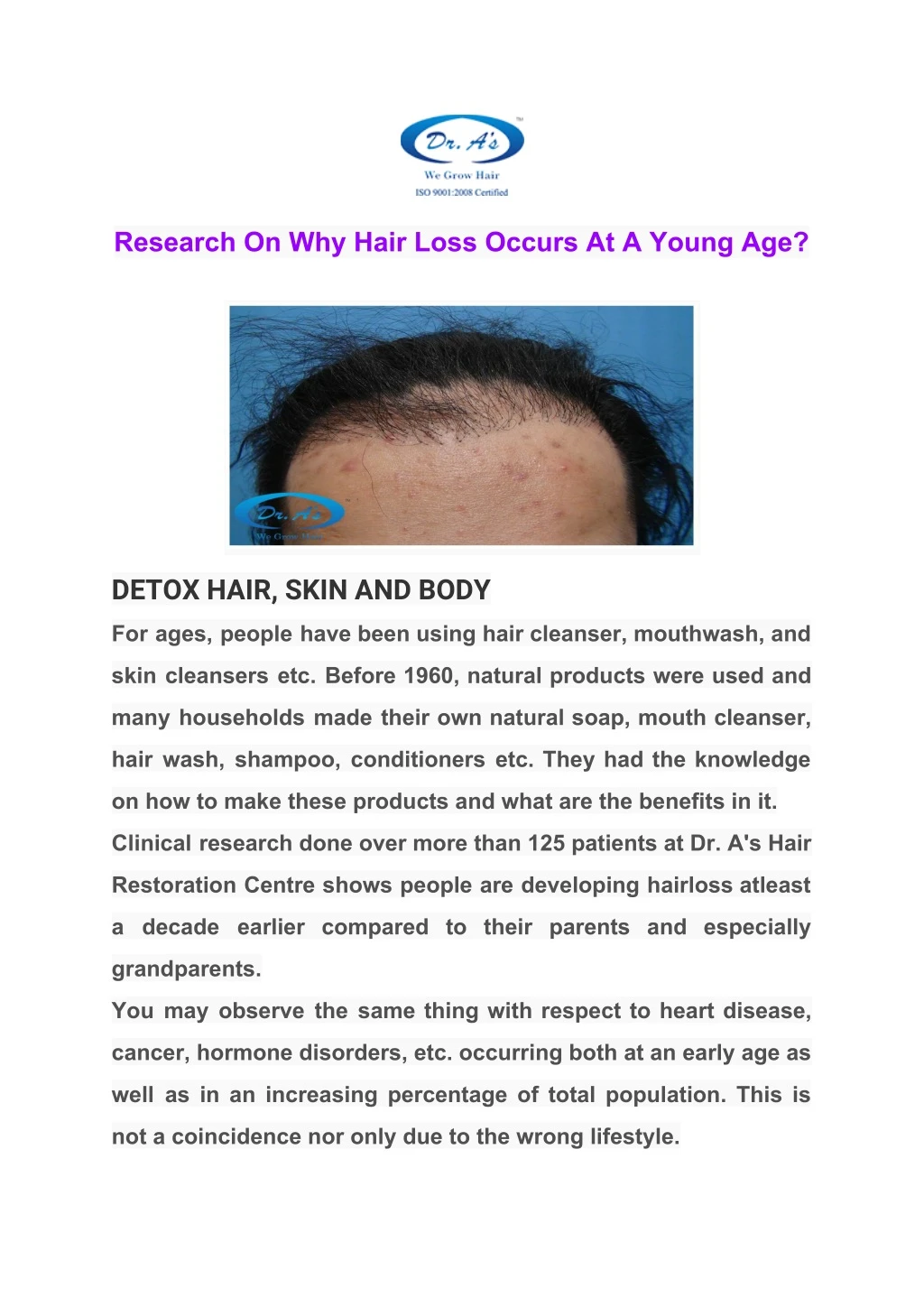 research on why hair loss occurs at a young age