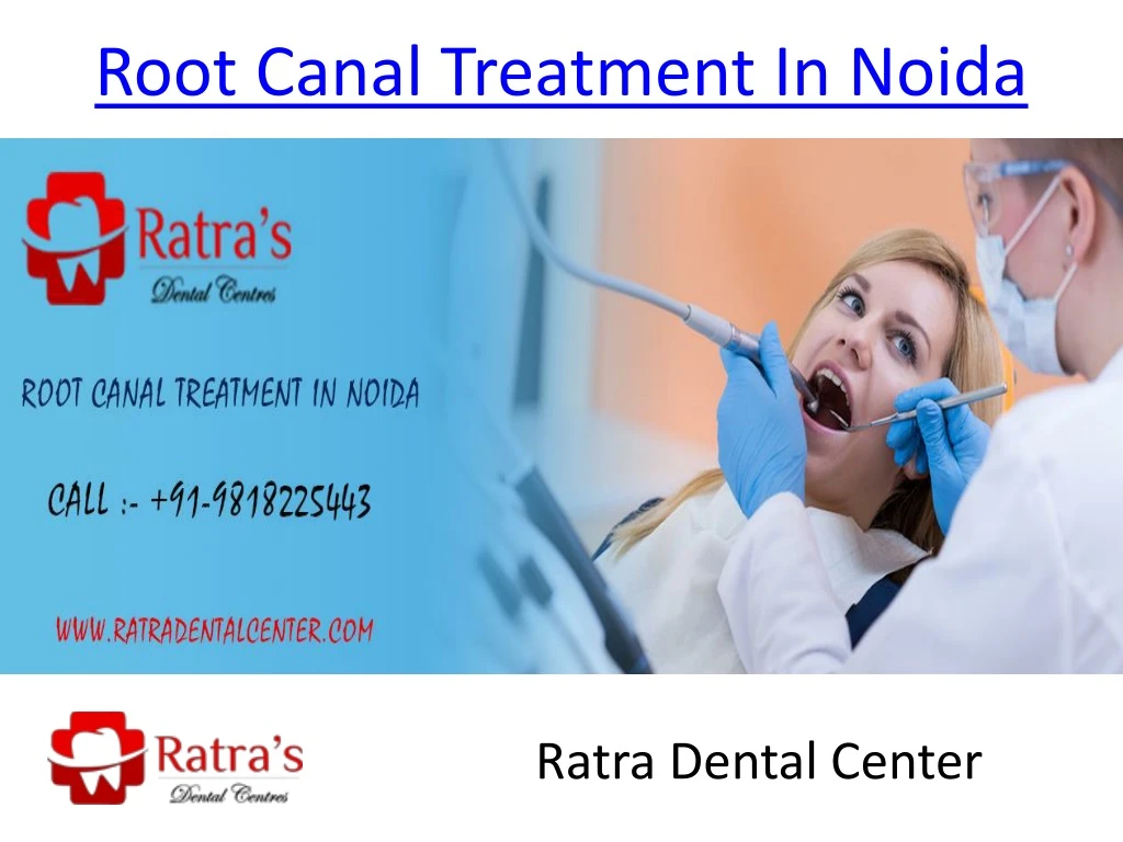 root canal treatment in noida