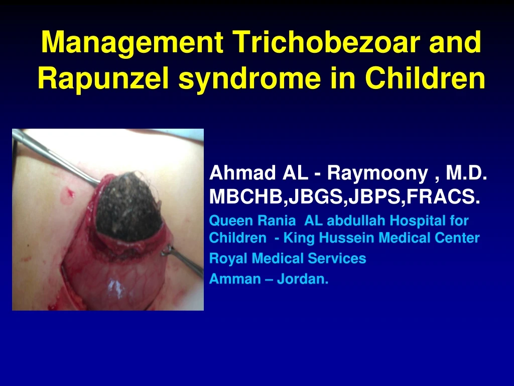 management trichobezoar and rapunzel syndrome in children