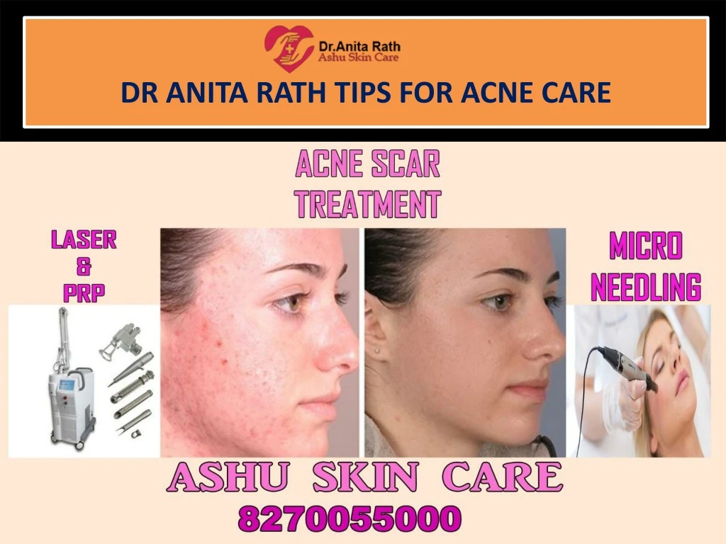 dr anita rath tips for acne care