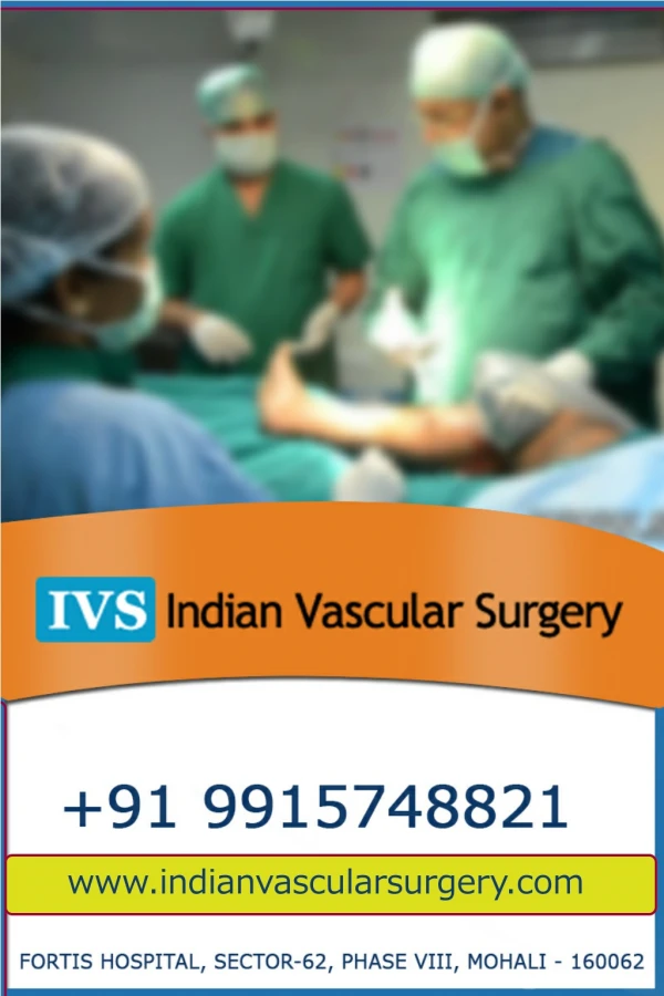 Laser Varicose veins Treatment - Indian Vascular Surgery