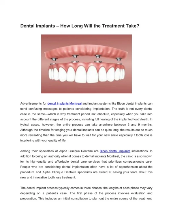 Dental Implants - How Long Will the Treatment Take?