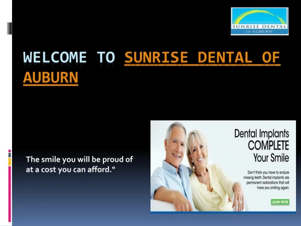 All on 4 Dental implants Auburn | Sunrise Dental of Auburn,WA