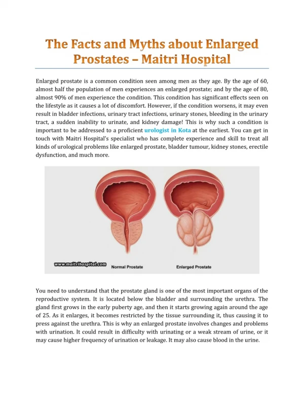 The Facts And Myths About Enlarged Prostates - Maitri Hospital