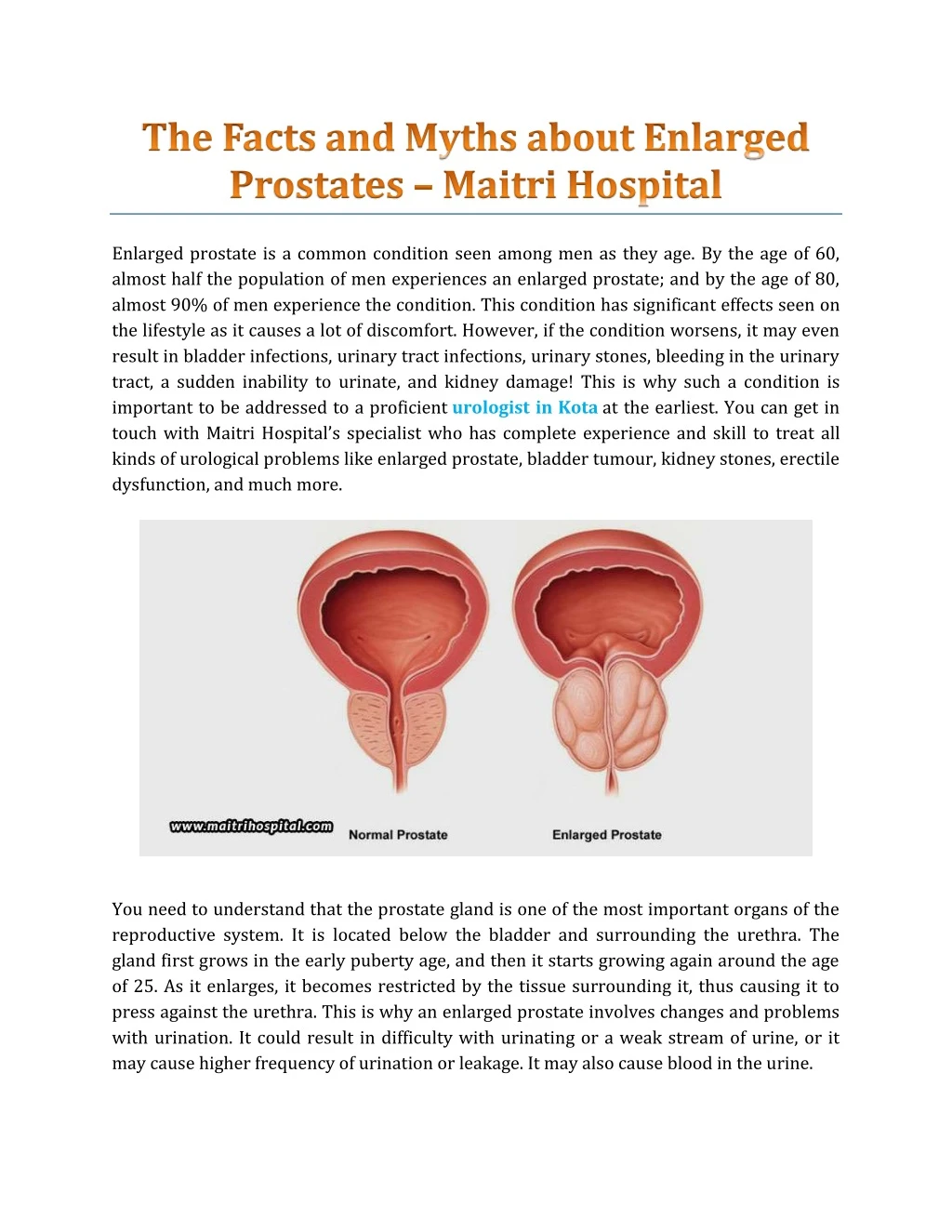 enlarged prostate is a common condition seen