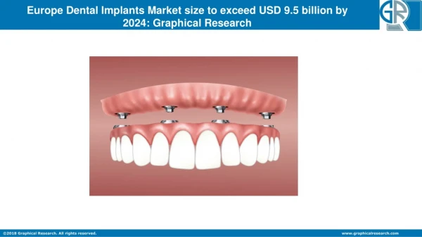 Europe Dental Implants Market A look at Trends and Statistics in the next 5 years