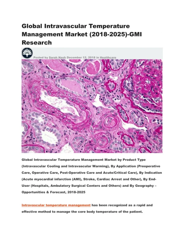 Global Intravascular Temperature Management Market (2018-2025)-GMI Research