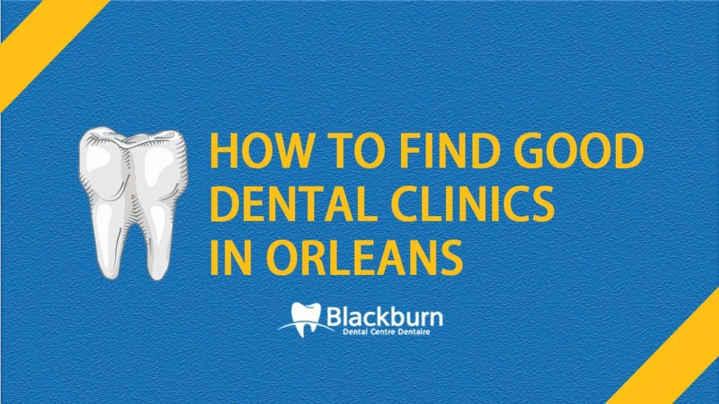 how to find good dental clinics in orleans