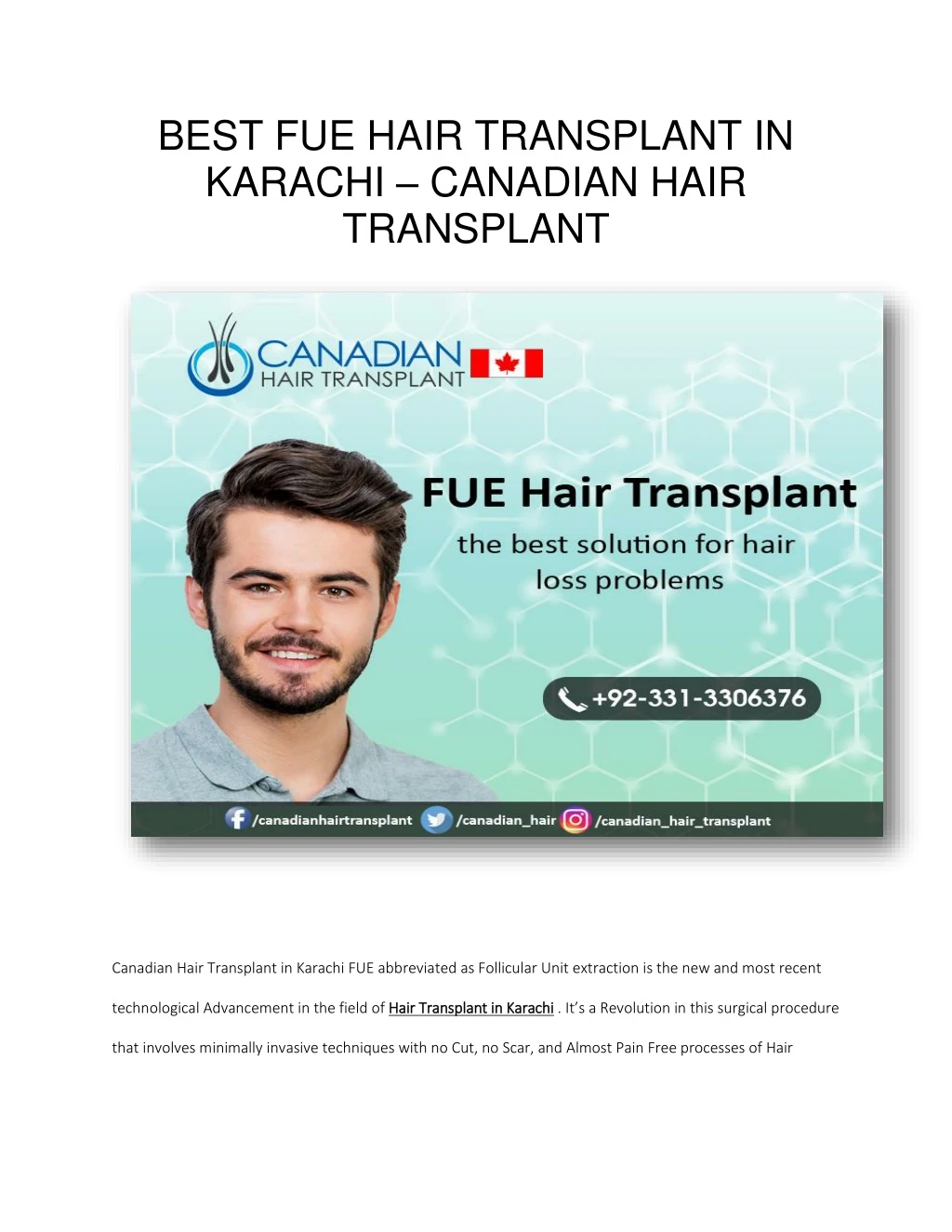 best fue hair transplant in karachi canadian hair
