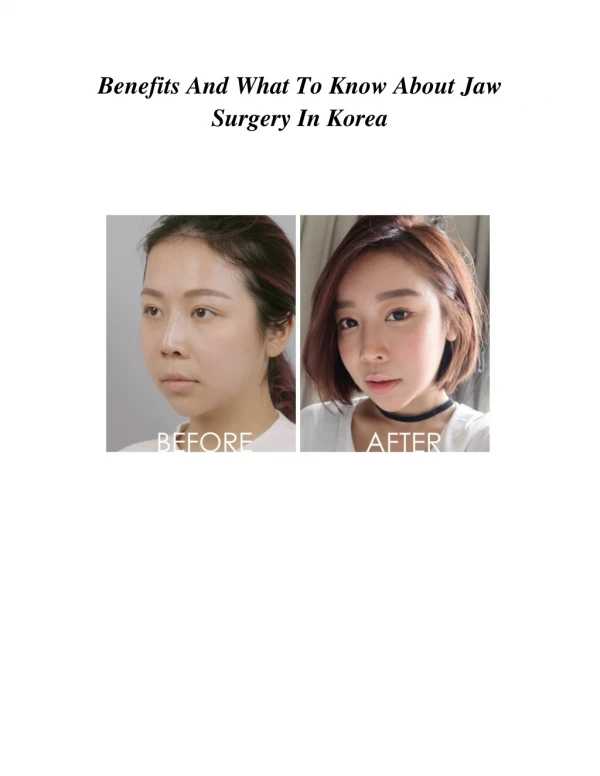 Benefits And What To Know About Jaw Surgery In Korea