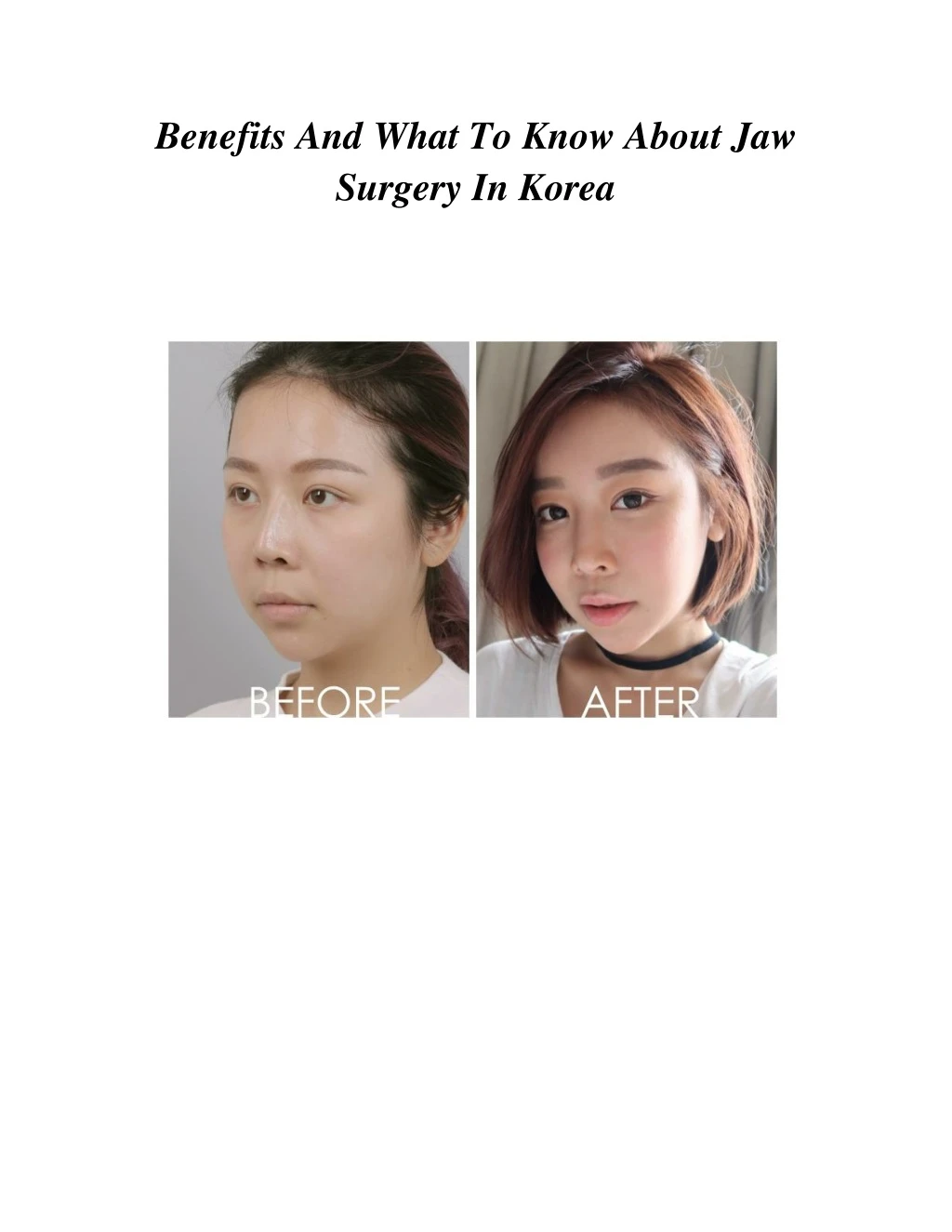 benefits and what to know about jaw surgery