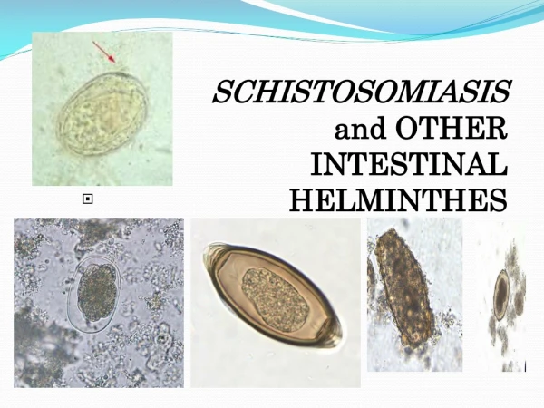 SCHISTOSOMIASIS 	 and OTHER 		INTESTINAL HELMINTHES