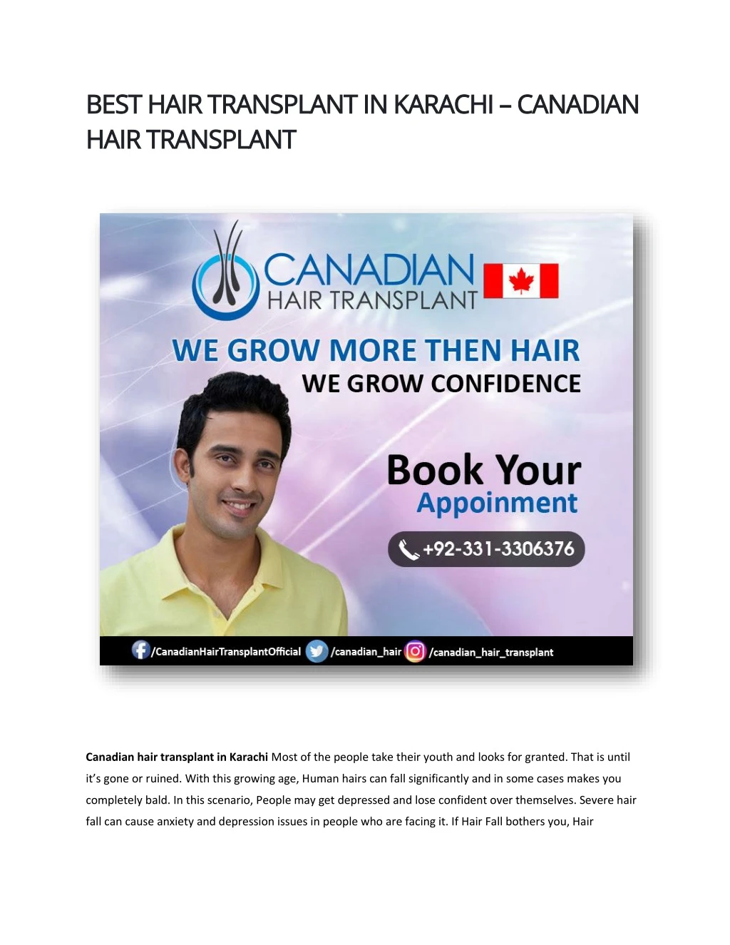 best hair transplant best hair transplant