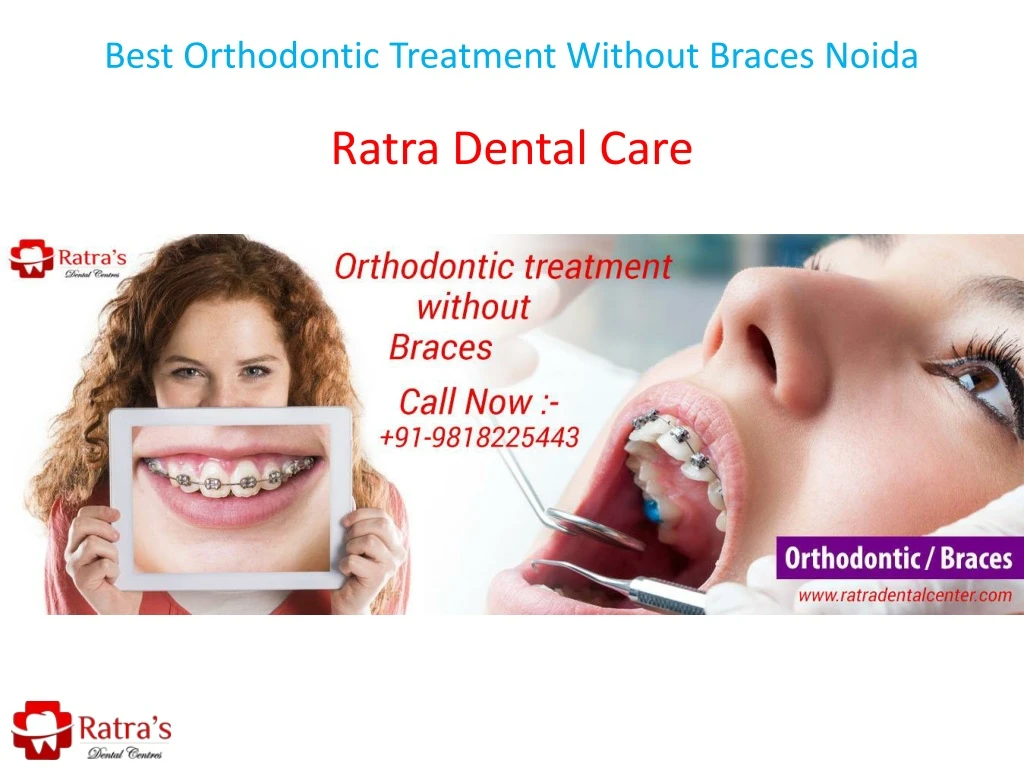 best orthodontic treatment without braces noida