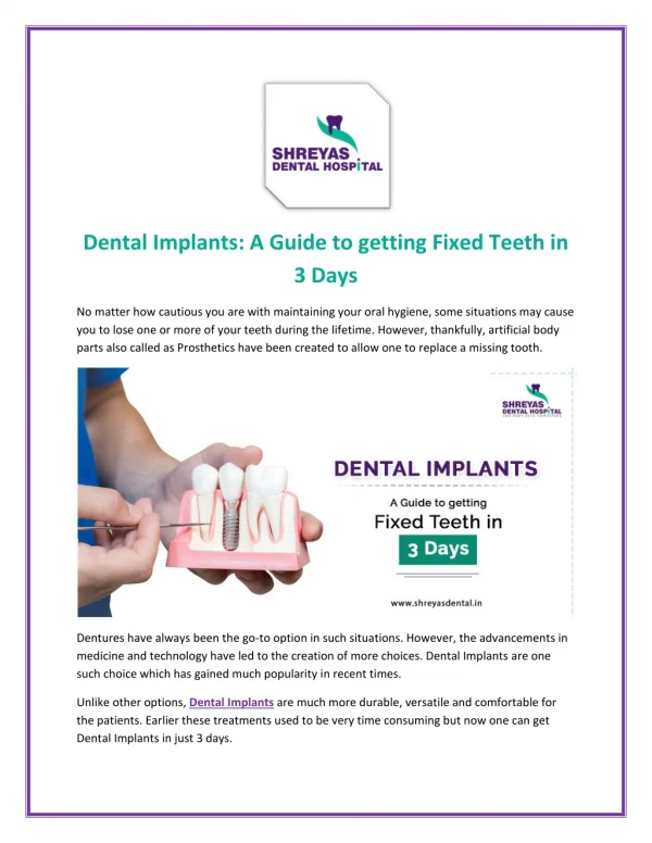 Dental Implants - A Guide to getting Fixed Teeth in 3 Days