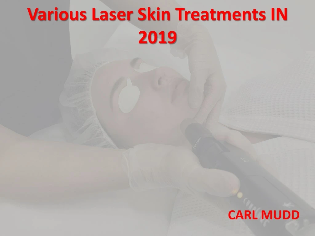 various laser skin treatments in 2019