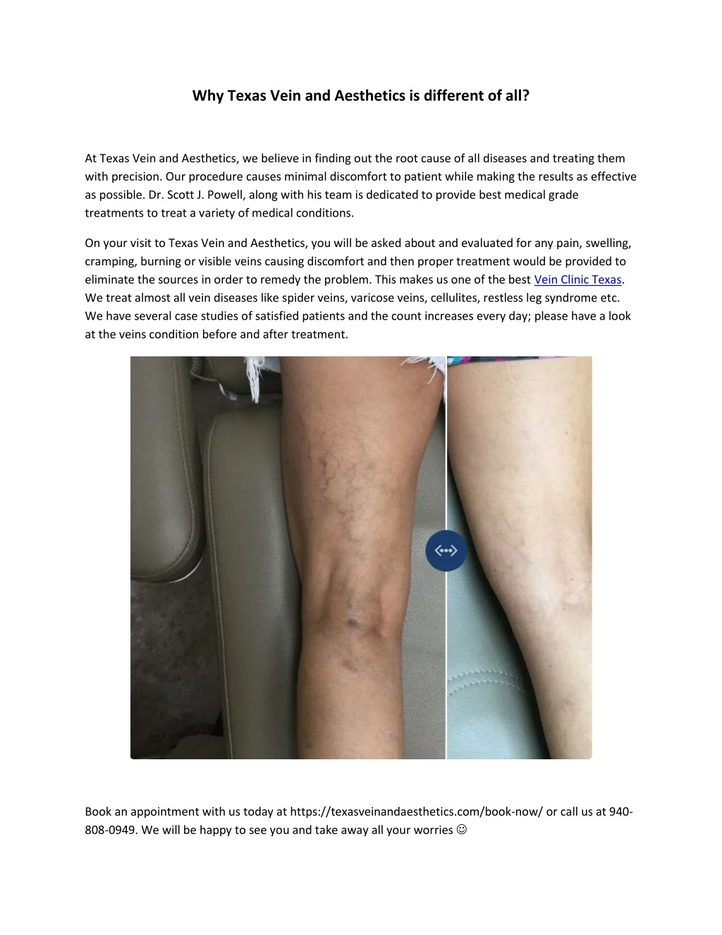 why texas vein and aesthetics is different of all