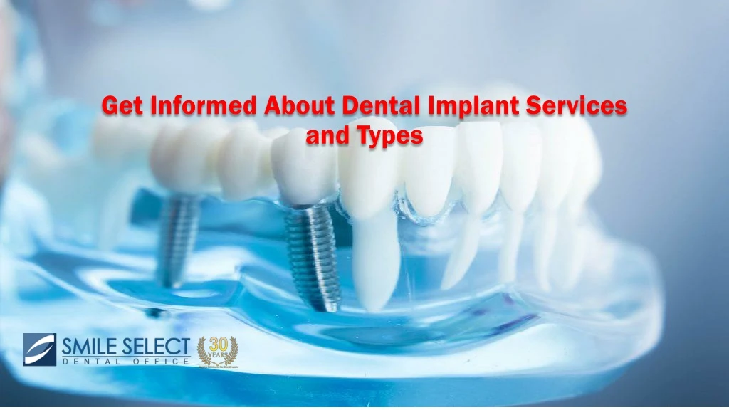 get informed about dental implant services and types