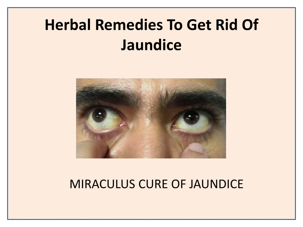 herbal remedies to get rid of jaundice