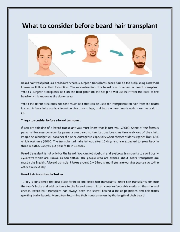 What to consider before beard hair transplant