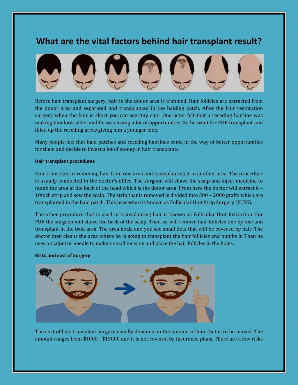 what are the vital factors behind hair transplant