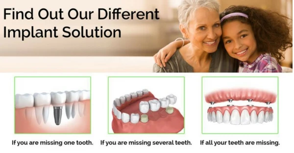 Different Dental Implant Solutions in London and Budapest by Hungary Dental Implant