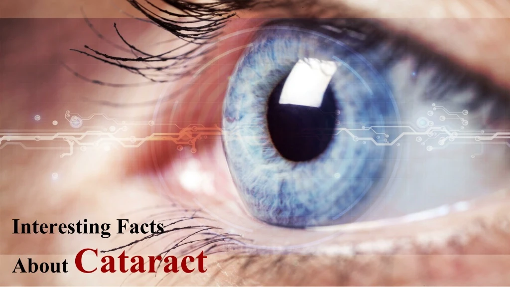 interesting facts about cataract