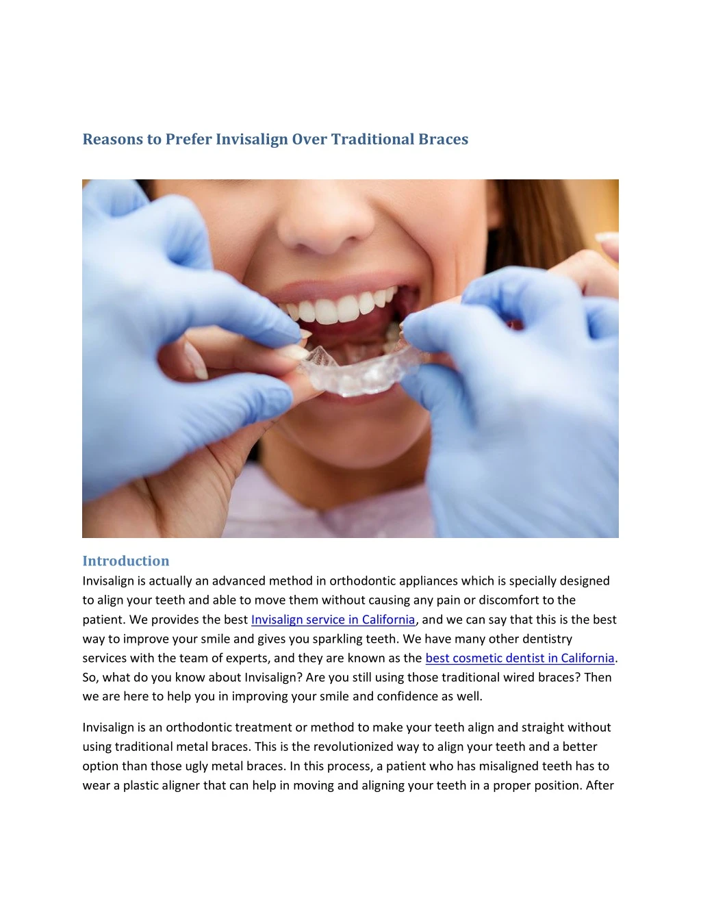reasons to prefer invisalign over traditional