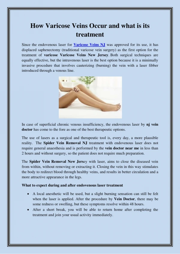 How Varicose Veins Occur and what is its treatment