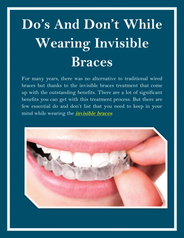 Do’s And Don’t While Wearing Invisible Braces