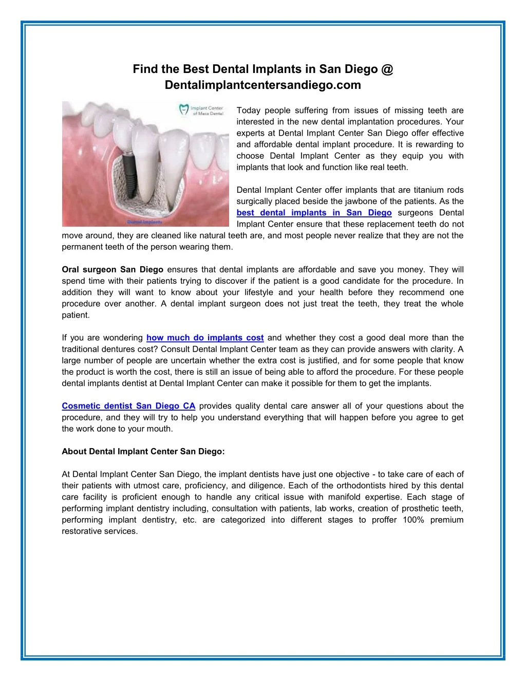 find the best dental implants in san diego